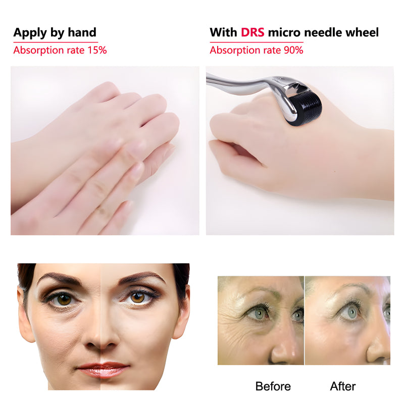 Multi-Function Microneedle Derma Facial Roller